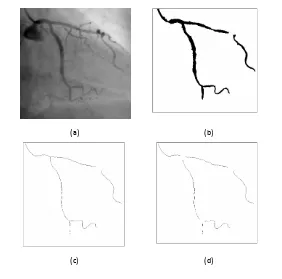 Fig 3 Candidate vessel location (a) LCA single frame (b) Binary Mask (c) Skeleton (d) Skeleton with bifurcationsremoved.