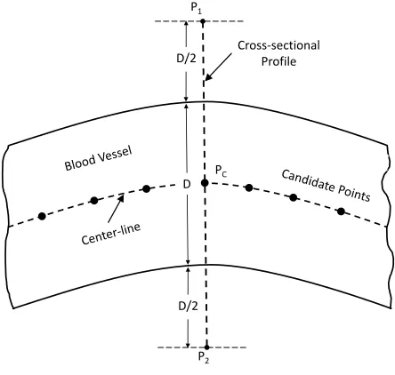 Table 2 Vessel parameter estimation: List of algorithm steps.
