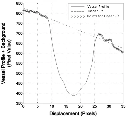 Fig 5 Example of background trend removal from the vessel proﬁle.