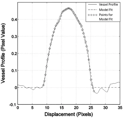 Fig 7 Example of ideal vessel model ﬁt to measured cross-sectional proﬁle.