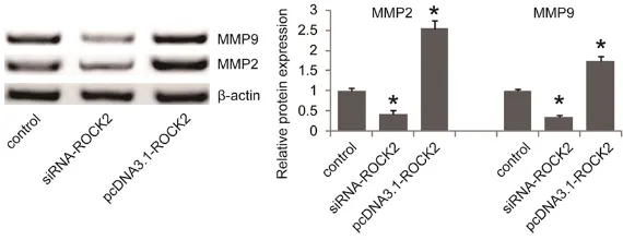 Figure 5. ROCK2 promoted MMP2 and MMP9 expression in BGC823 cells. Western blot was carried out to examine the effect of ROCK2 on the expres-sion levels of MMP2 and MMP9 in BGC823 cells transfected with ROCK2 siRNA (siRNA-ROCK2) and ROCK2 expression plasmi