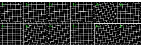 Fig. 3. Liver microscopy image segmentation. (Left): A colorimage deconvolved into three stain components; (Right): aclose-up view of segmentation result.