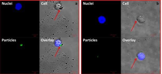 Fig. 11. Visualisation of (a) nanometre-sized UHMWPE wear particles and (b) 0.1–1.0 micrometre-sized UHMWPE wear particles internalised by PBMNCs cultured on agarosegel