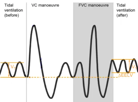 Figure 1. Spirogram of lung volume changes during the examination. Four phases are recognized: spontaneous tidal breathing, vital capacity maneuver, forced expiration ma- neuver and again spontaneous tidal breathing