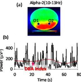 Figure 5.  (a) Topographic map showing the alpha-2 (10 - 13 Hz) rhythm dominant region; (b) Temporal waveform of the EEG occipital (O1, O2) alpha-2 power was illustrated with the slower-component curve calculated from the temporal power waveform