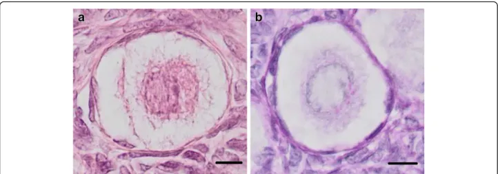 Fig. 1 Primordial ovarian follicles in a 21 year old woman. a – stained with haematoxylin-eosin