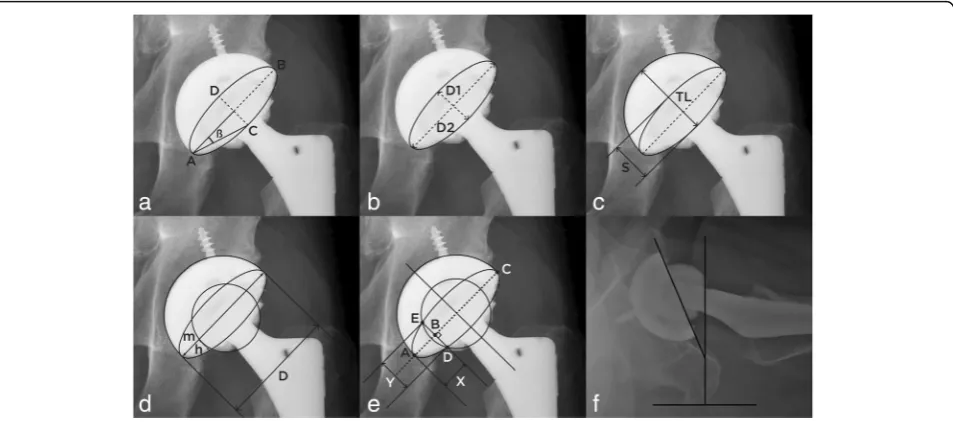 Fig. 1 atotal length of the acetabular component are used to calculate the anteversion.ellipse and the head edge are used to calculate anteversion.The long and short axes of the ellipse are used to calculate the anteversion