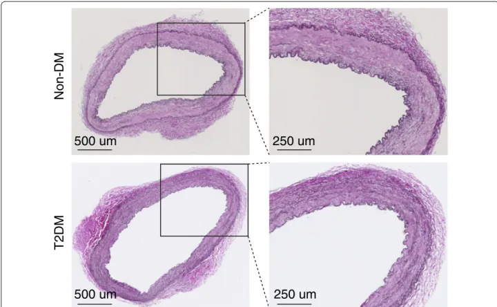 Fig. 1  Representative internal thoracic arteries (ITAs) from T2DM and non-DM patients