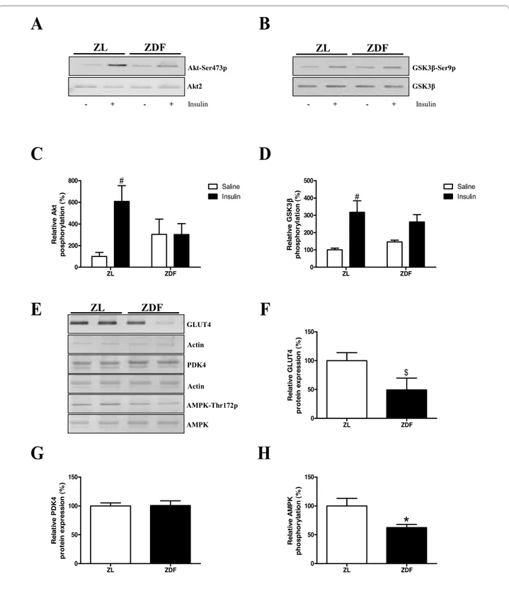 Figure 3 Molecular changes in right ventricular insulin signaling. Immunoblots showing Akt (A) and glycogen synthase kinase (GSK)3β (B) and 