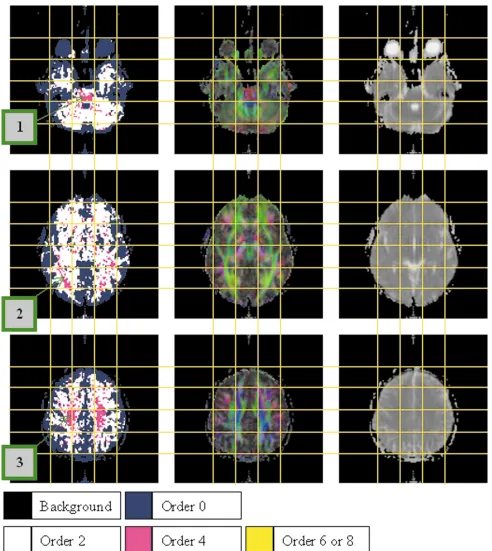 FIG. 4. Order maps from human brain data (left) together with color-coded principal DT direction maps (middle) and mean diffusivity maps(right)