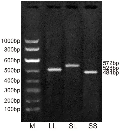 Figure 1. PCR-RELP shows SS, LL and SL genotypes of 5-HTTPRL gene. Notes: M, 100 bp DNA ladder marker; 528 bp, LL genotype; 572 bp, SL genotype; 484 bp, SS genotype; 5-HTTPRL, serotonin-trans-porter-linked polymorphic region; S, short; L, long; PCR-RELP, Polymerase chain reaction-restriction fragment length polymorphism.