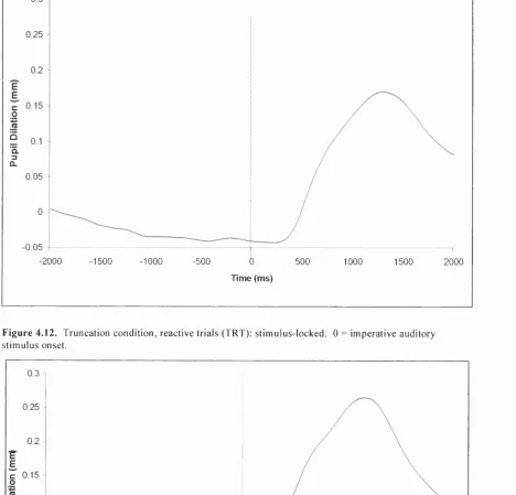 Figure 4.11. Simple reaction time condition (SRT): stimulus-locked. 0 = imperative auditory stimulus onset.