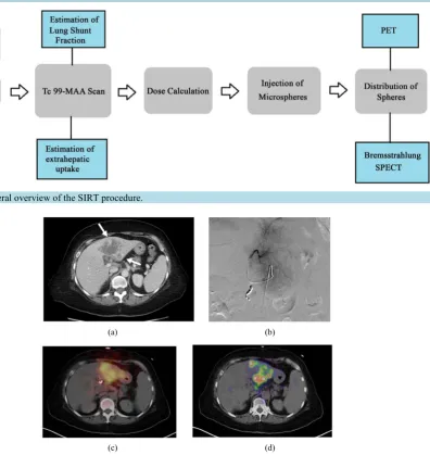 Figure 2. General overview of the SIRT procedure.                                                              
