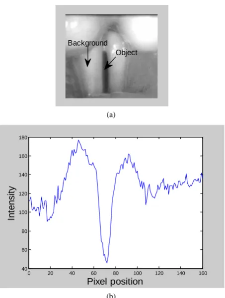 Figure 2. (a) An image frame from the HSDI recording, and (b) the grey-level intensity profile along the mid-line of the vocal fold