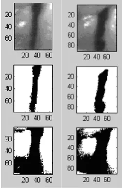 Figure 3. Comparison of the results of segmentation; the upper row shows two input images, the middle row shows the segmented images using our two-step approach, and the lower row shows the segmented images using Otsu method