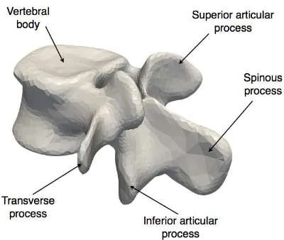 Figure 1. A lumbar vertebra and its main regions.