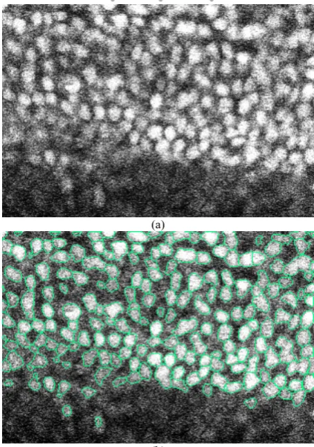 Figure 82D slice view of the original image and segmentation result in Figure 92D slice view of the original image and segmentation result in Figure 8