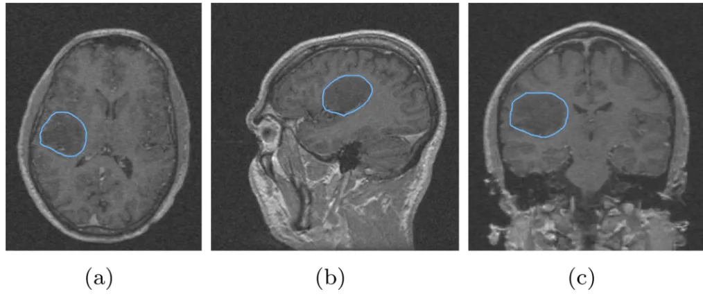 Figure 5.Segmentation of the image with additive zero mean Gaussian noise with standard deviation