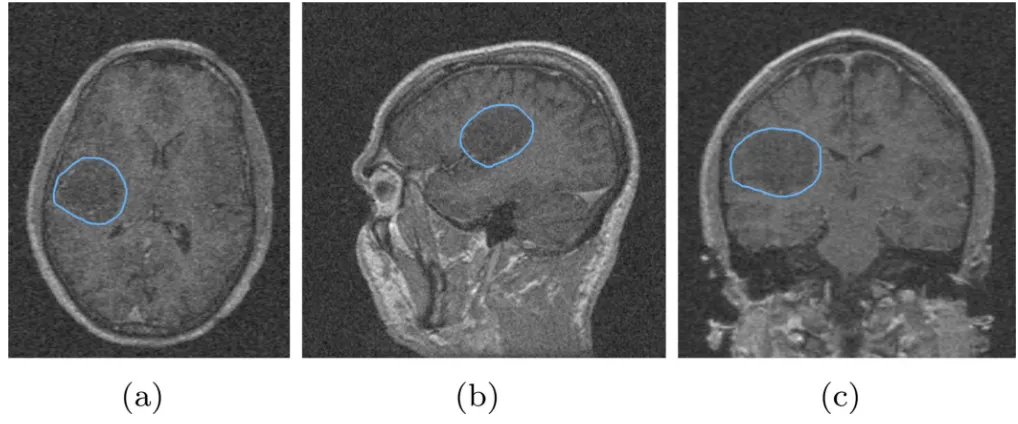Figure 6.Segmentation of the image with additive zero mean Gaussian noise with standard deviation