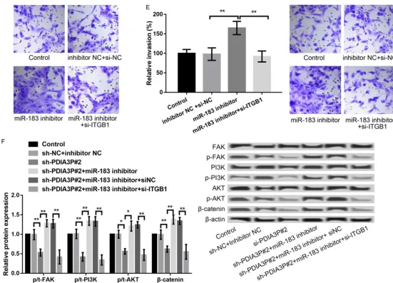 Figure 4. miR-183 regulated tumor growth and metastasis through targeting ITGB1. A: qRT-PCR and western blot showed the ITGB1 expression in MCF-7 cells after transfection with si-NC or si-ITGB1