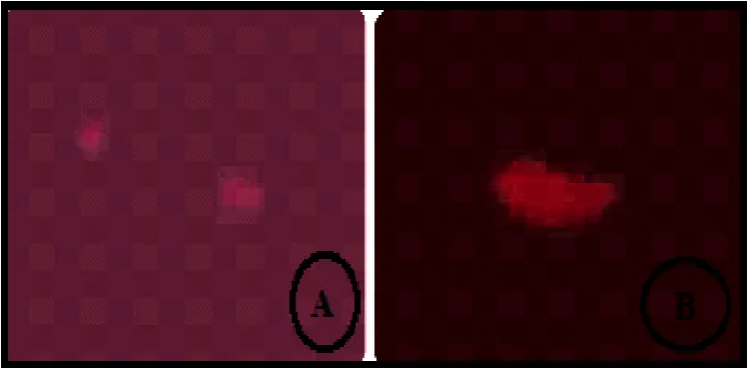 Figure 3: Comets observed under Fluorescent Microscope A) Normal and Comet,  (B)    Damaged DNA with comet