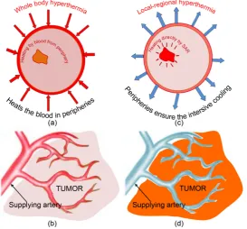 Figure 3). In this case, the blood cools the tumour, causing completely opposite heat-flow than in WBH (In the local-regional hyperthermia, the blood remains at body-temperature while the target is focused to heat