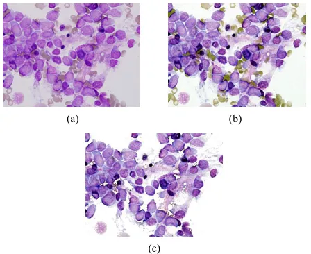 Figure 14. Image of fewer leukocytes: (a) Primal image; (b) Image by the adjusted CCIN; (c) Leukocyte image by hue threshold