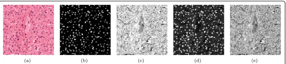 Figure 6 Parameter optimisation for colour deconvolution of a histology image (see case study)