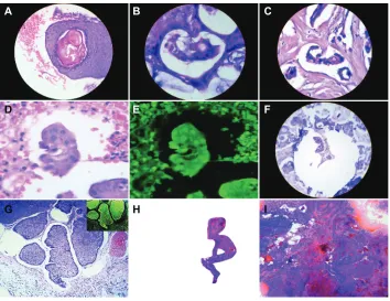 Figure 3 Close-up observation of scheduled short crystal migrations that guide and sculpt the surrounding silhouette characteristics of the embryo body with surprising body segmentation generated by massive crystal synchronic migrations in a case of undiff