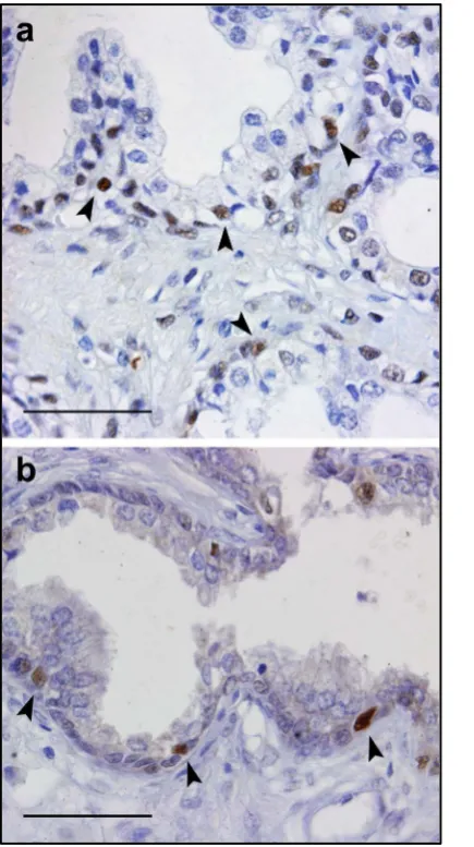 Figure 2. Sections immunostained to PCNA, from a specimen of CTR group (a) and from a case of BPH group (b)