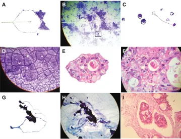 Table 1 Relationship between geometric triangular chiral crystal complexes and crystal comet effect tail assembly