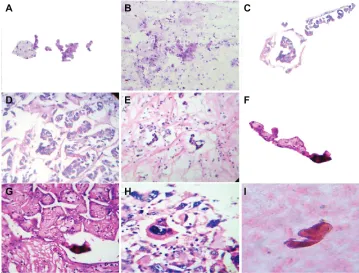 Figure 3 The crystal comet effect tail generates alignment of fractal embryoid bodies