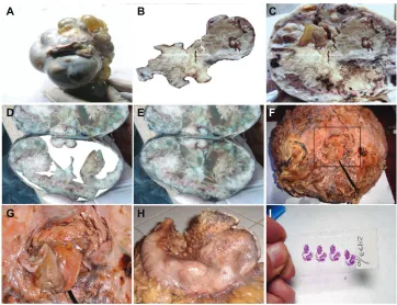 Table 2 Relationship between crystal comet effect tail assembly and embryoid body pattern