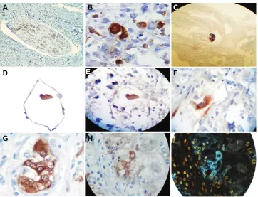 Table 3 Embryoid body selective distribution of neuron-specific enolase antibody immunopositivity