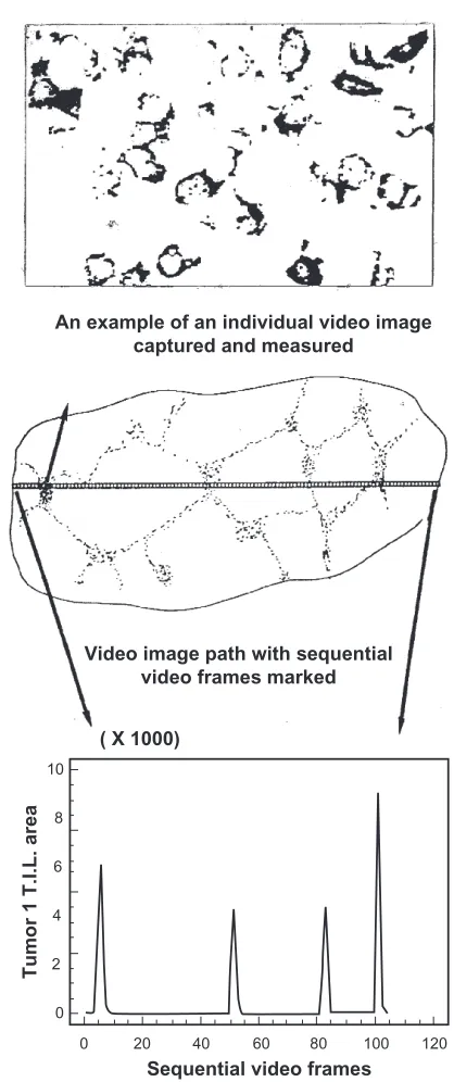 Figure 1 An example of the standard quantal visual scale method for grading immunostained cells, as used for this study.