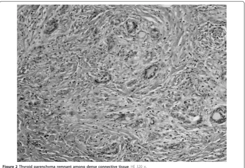 Figure 2 Thyroid parenchyma remnant among dense connective tissue. HE 320 ×.