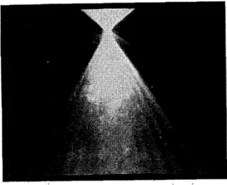 Figure 1.3.1: Ashkin’s 1986 microscope image of an optically trapped microsphere,showing, in the striations, the distinctive Mie scattering interference orders.