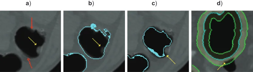 Figure 1 Pipeline of the presented CADpolyp system.