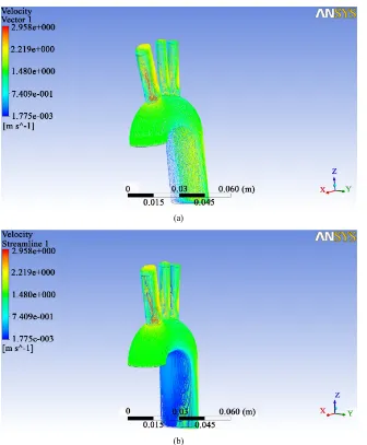 Figure 5. WSS profile in the first case.                                                       