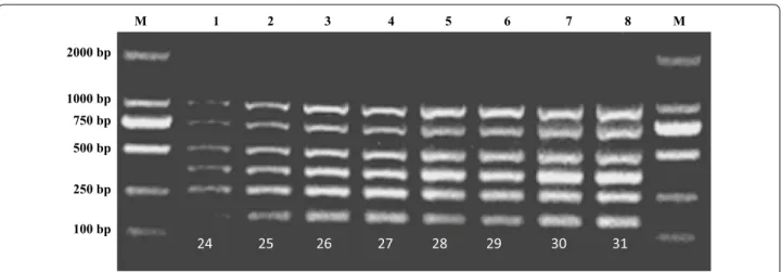 Fig. 3  Determination of time of the multiplex PCR. Lane M: 2000 bp DNA marker; Lane 1: 24 running cycles; Lane 2: 25 running cycles; Lane 3: 26 