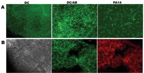 Figure 3. Wide angle micrographs of membrane permeabiliza-tion in seedlings infected with different microbes.microscopy of seedlings sytox green staining in green fluorescencechannel