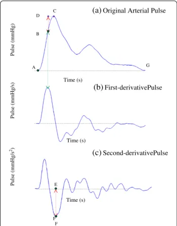 Figure 4 (a) The oscillation procedure of the arterial pulse is separated by points A, B, and C, and divided into two segments A ! B and B ! C