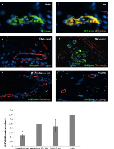Fig 3. The local complement regulator MCP (CD46) is reduced on vascular endothelial cells of SSc skin biopsies