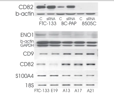 Figure 1 Upper panel: expression of CD82 in thyroid carcinoma cell lines treated with siRNA targeting AUF1