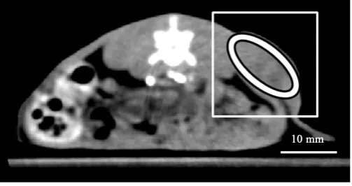 Figure 3. Illustration of a region of interest (ROI) drawn on the tumor rim (white ellipse)