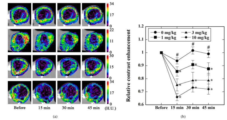 Figure 5. (a) Typical example of the CE images before and 15 min, 30 min, and 45 min after the administration of L-ARG in Study 2 (Figure 2)