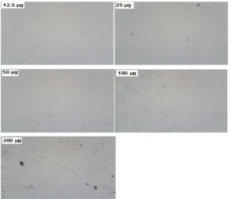 Fig. 6(a) EDAX micrograph of silver nanoparticles synthesized by Solanum nigrum.  (b)EDAX micrograph of silver nanoparticles synthesized by Cardiospermum 
