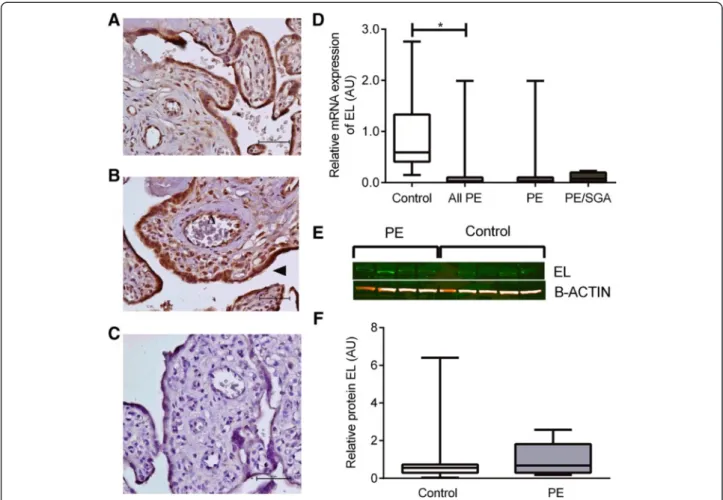 Fig. 4 EL. a Immunohistochemisty for the detection of EL in control placenta, b immunohistochemistry in PE placenta, open arrow indicates endothelial cell staining, closed arrow indicates trophoblast staining