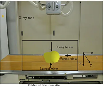 Figure 9. Positioning of 3DCG phantom by the training tool. (a) Direction of X-ray beam; (b) Schema of the rotation of the 3DCG phantom on lateral view
