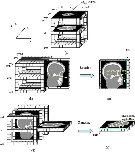 Figure 5. Production process of sagittal plane images and new transverse plane images from CT image data